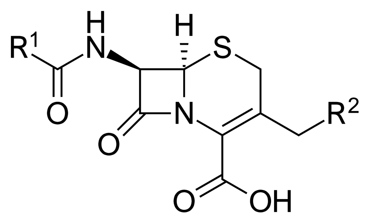 A photograph of Beta